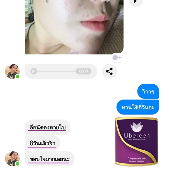 รีวิว Ubereen Collagen ผิวขาวใส